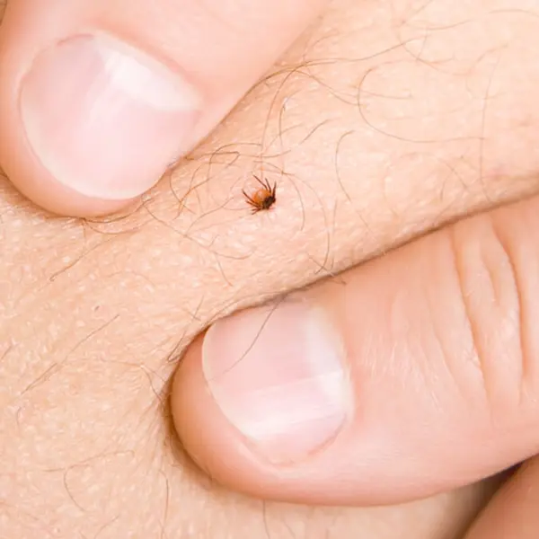 Инфестация